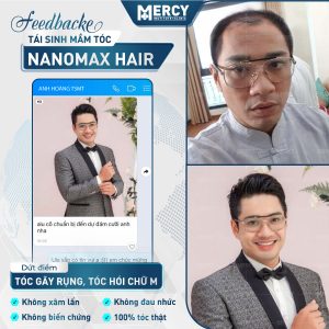 Nanomax Hair,rụng tóc,hói đầu