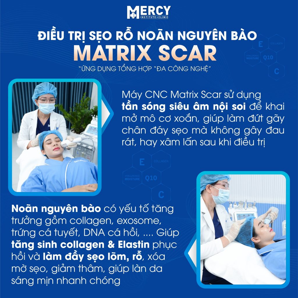 Ứng dụng tổ hợp đa công nghệ trong điều trị sẹo rỗ tại phòng khám Mercy