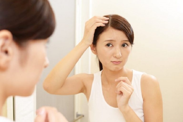 Cách chữa rụng tóc tại nhà